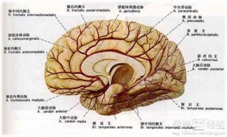 一个手术阻断颈部动脉狭窄导致的手脚乏力，揭示脑梗可能风险