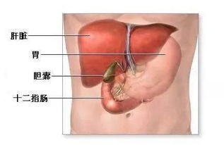 胆囊结石与癌症的准确距离，从哪些方面看出两者间的关联性?