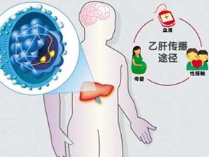 了解并防范：各种细菌感染的高风险传播途径