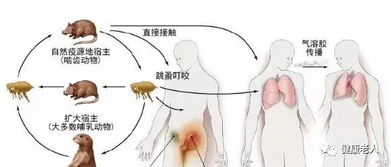 了解并防范：各种细菌感染的高风险传播途径