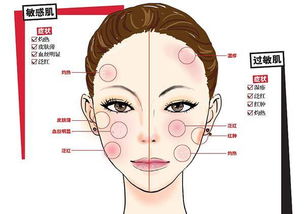 日益严重的过敏问题：原因、影响与解决方案