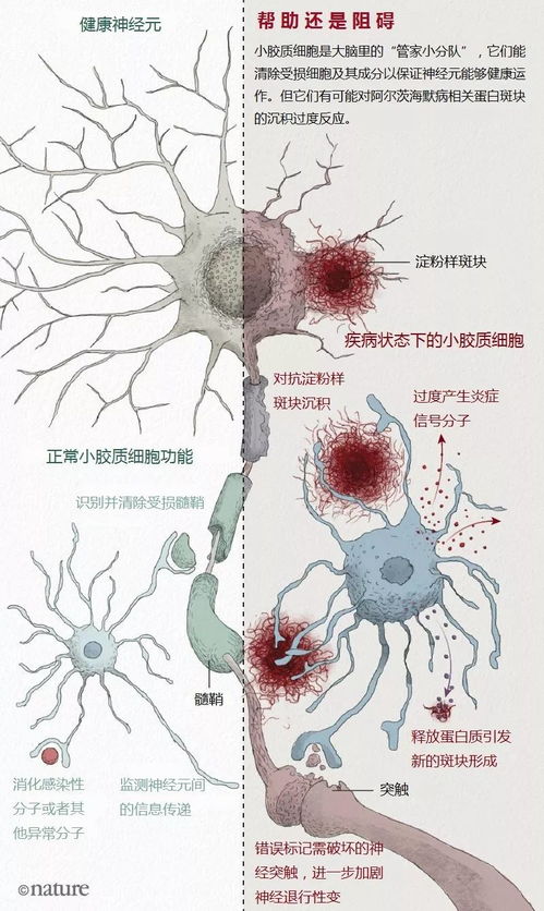 了解基因变异与阿尔茨海默病风险：一项最新的研究表明