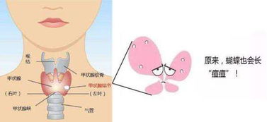 28岁职场新挑战：甲状腺结节可能成为你的健康问题？你需要如何应对？