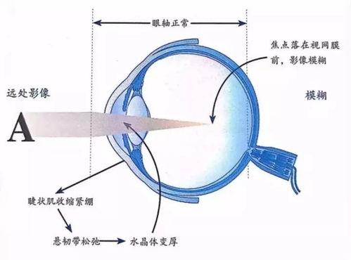 解析视力问题：为何孩子近视？未被知的成因和解决方法