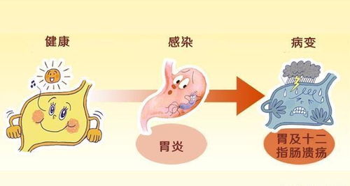 清除‘垃圾蛋白’，治愈渐冻症的新疗法展示在最新科学进展中