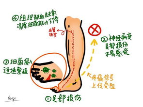 警惕!五个脚部信号表明可能血糖超标，切勿忽视