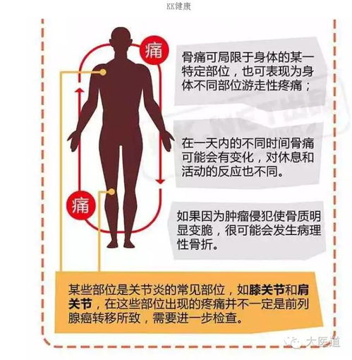 如何预防男性前列腺癌？兄弟三人的健康警示：这可能是你的答案！