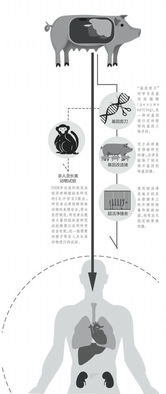 中国研发创新，国际上首次成功采用自体再生胰岛移植治疗2型糖尿病