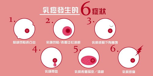 乳腺癌严重威胁女性健康：警惕三种常见疼痛，如有疑及时就医