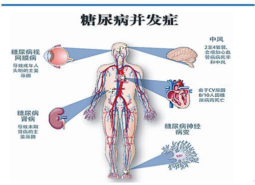 25年糖尿病病史患者成功治愈？权威专家对此表示，研究成果仍需不断推进