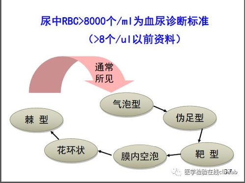 深度解析：如何正确看待就医行为中的化验小便检查是否过度医疗? 高血压应查哪些项目?