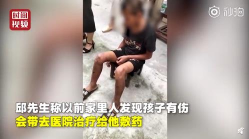 警惕：留守儿童遭绑鞭打事件！教育资源并非万能，要关注孩子的身心健康