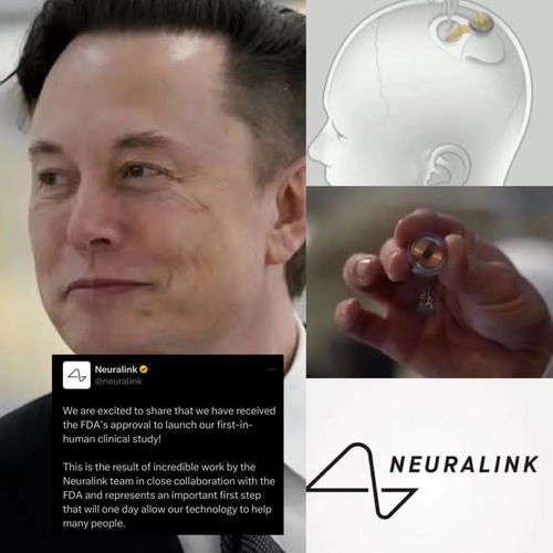 马斯克首个脑机接口测试失败！Neuralink：接线脱落，存在安全隐患？

这个标题简洁明了地传达了消息的核心，没有使用过于复杂或专业的术语。同时，“马斯克首例脑机接口人体试验曝故障”表明了事件的重要性，使得读者对这一新闻有更深入的了解。