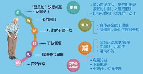 世界狼疮日：长治久安的治疗方法与风险控制