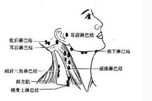 您的孩子脖子上有淋巴结肿大？这是不是结核的症状?