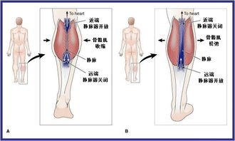 根据腿部静脉曲张的严重程度，手术需求程度各有不同