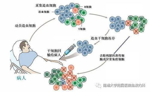 浙江大学揭示：微塑料粒子影响人体造血功能的研究成果