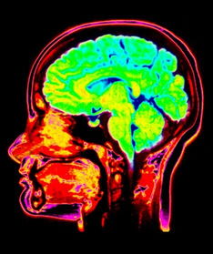 科学家揭示：人类独特的视觉系统与其它生物的有所不同