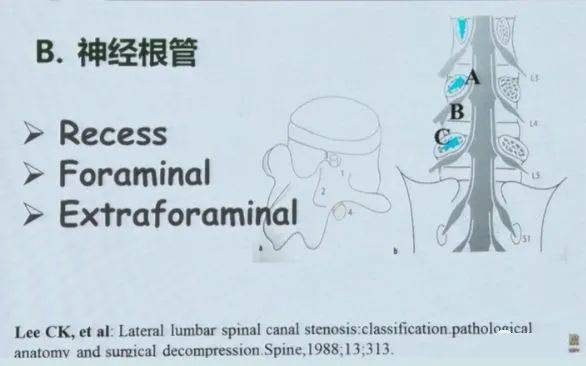 深入解析：手指割破的梦境含义及解读