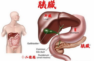 糖尿病与癌症：癌症的潜在并发症