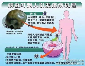 夏季来临：预防蜱虫叮咬的科学知识和专家解读