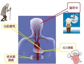 辨别高血压误区，一病百症了解8个关键点