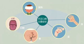 手足口病高发季，提醒您关注孩子的口腔、手脚、臀部等关键部位