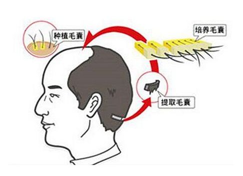 你需要了解哪些人有中风的风险？7个潜在迹象要警觉！