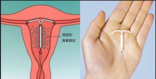 潮评：法拍避孕套：有必要还是无必要？