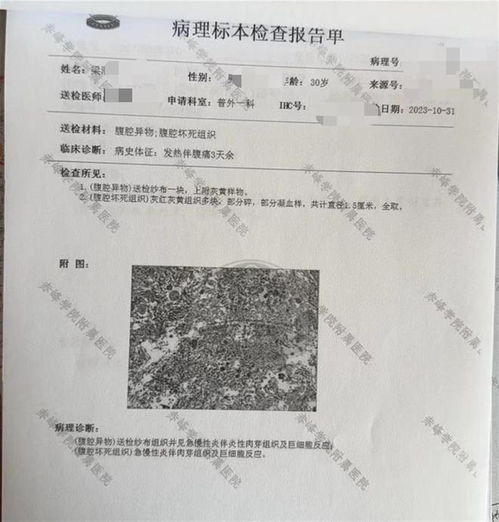 赤峰男子阑尾炎术后15月内发现纱布，地方医调委已介入