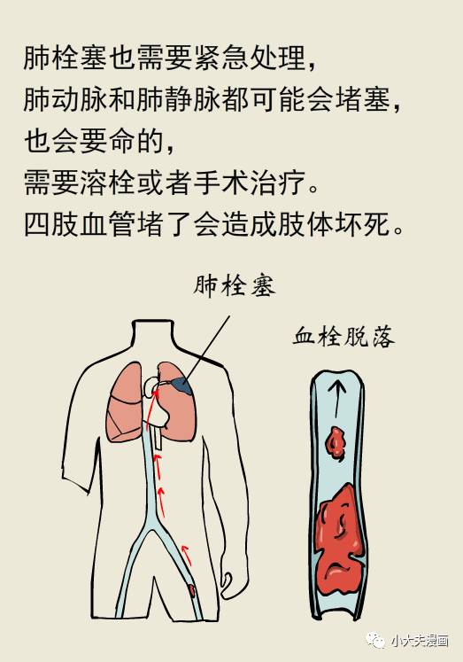 提升身体素质：预防中风及心脏疾病的方法

如何降低中风及心脏疾病的风险？