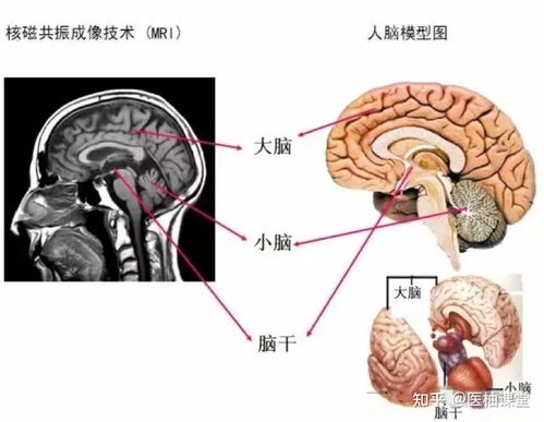 中国‘冷冻人脑组织复活’取得重大突破：初步探索冷冻人体潜力，揭示生命起源奥秘