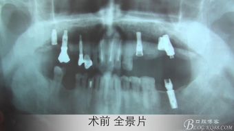 洗白失败的新生：新问题浮现，让我们继续探索

优化后的 
1. 问题重生：洗白失败的新生揭示
2. 深入探讨：新现象引发疑问与挑战
3. 困境解剖：洗白新尝试的结果与反思
4. 深度剖析：失败洗白的新课题与启示