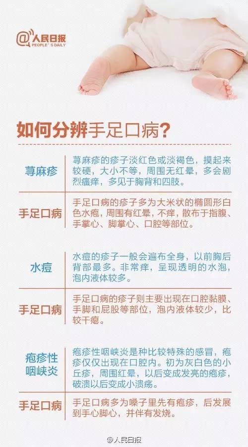 热门疾病：当前尚无专门针对猩红热的疫苗，建议加强预防措施