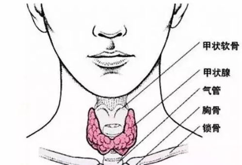 世界甲状腺日：甲状腺疾病容易找的人群有哪些，甲状腺结节需要手术吗?