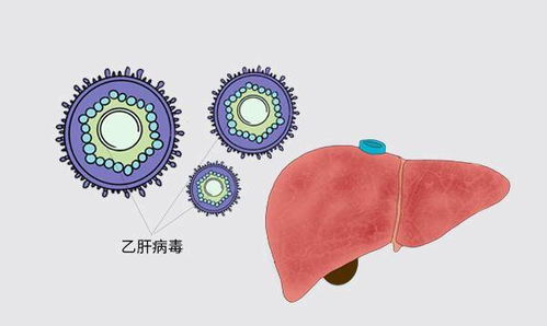 重要提示：乙肝症状时好时坏的原因及解决方法