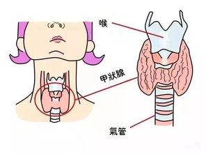 了解甲状腺疾病：一种可能危害多个器官和系统的慢性病症