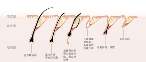 夏季实用：纺织材料的多种健康和医学用途