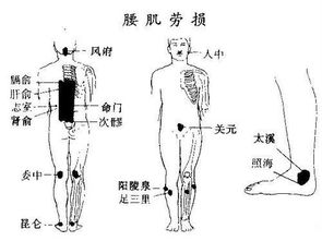 关键预警：关注脊椎病，让你的腰背健康无忧