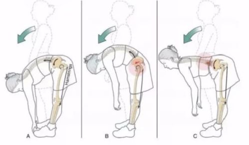 全面解读：深蹲后膝盖疼痛的预警因素与应对策略