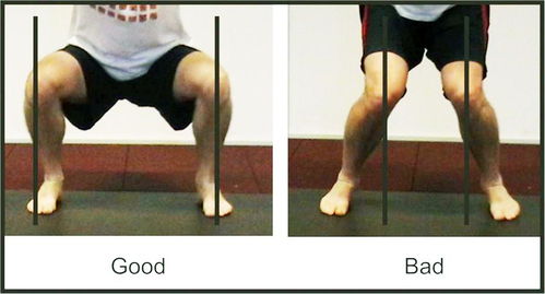 全面解读：深蹲后膝盖疼痛的预警因素与应对策略