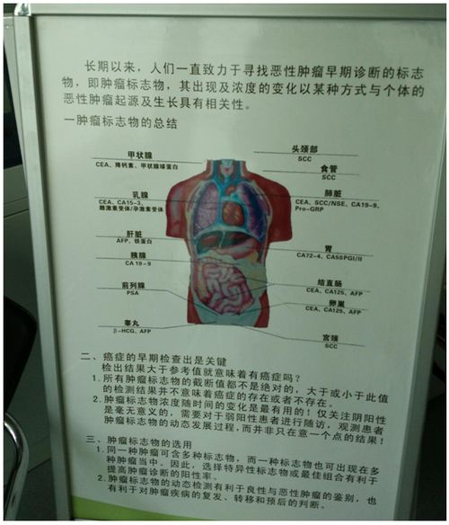 三大癌症标志物推荐：卵巢癌风险增高的原因和处理方式