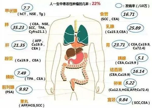 三大癌症标志物推荐：卵巢癌风险增高的原因和处理方式