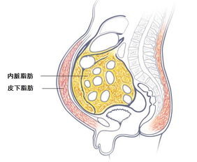 腹部长大意味着脑容量减小？其实背后有4大‘元凶’！