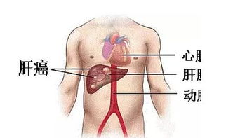 关于肝癌的三个身体信号，当您有这些症状时，请务必关注！