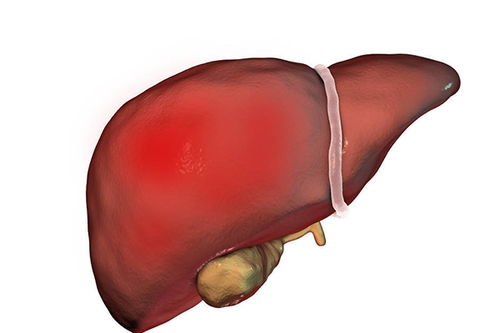 关于肝癌的三个身体信号，当您有这些症状时，请务必关注！