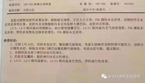 福建多个家庭中出现癌症病例，医生提醒：别让类似习惯再发生！