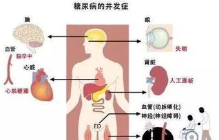 牢记糖尿病长期管理要点：了解这7个重大并发症的风险因素