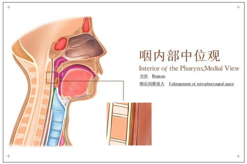 肺结节恶化3月：为何扩散且伴有屁股痛与喉咙异物感？