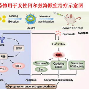 阿尔兹海默症虚假论文可能扰乱药物研发进程